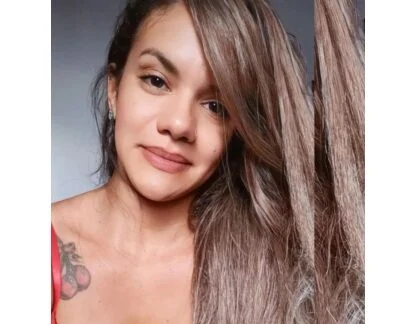 Mulher passa por cirurgia de reconstrução facial após tentativa de feminicídio em Natal